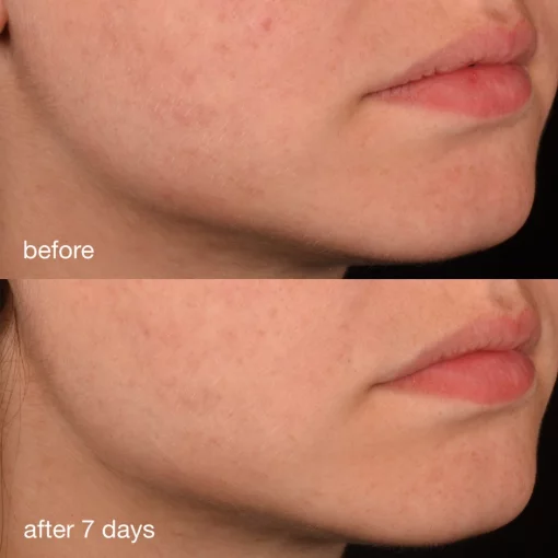 Dermalogica Pro-Collagen Banking Serum, 30 мл - Антиоксидантна сироватка з колагеном